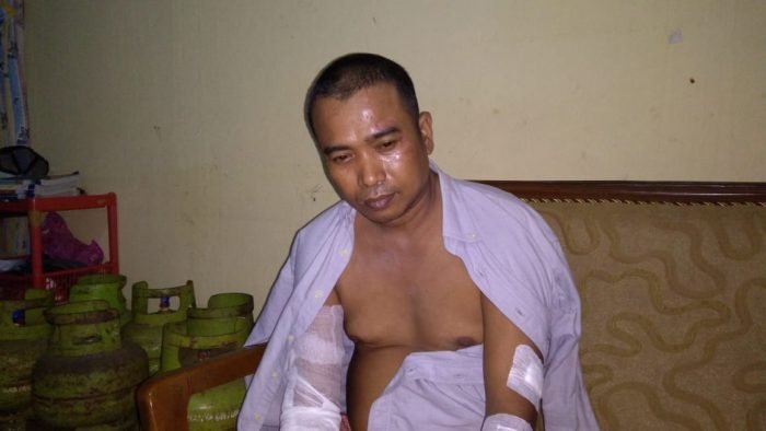 Tamrin  korban dari pembacokan di depan masjid At -Taqwa Jalan  Wiluyo  Puspoyudo Kelurahan Klandasan,  Kecamatan Balikpapan Selatan, saat ditemui di kediamannya Senin (19/4/2021). Foto : BorneoFlash.com/Muhammad Eko.