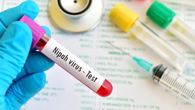 Ilustrasi, Virus Nipah (iStockphoto/jarun011)