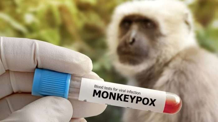 Ilustrasi Monkeypox. Foto: iStockphoto