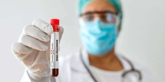 Antisipasi Mpox: InJourney Airports Tingkatkan Kewaspadaan di 16 Bandara Internasional Menjelang Event Besar