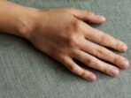 Ilustrasi. Jangan Anggap Sepele Perubahan pada Kuku, Bisa Jadi Peringatan Kanker Paru. Foto: Freepik