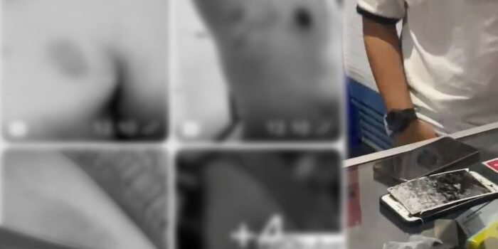 Dugaan Pengeroyokan Ketua SMSI Kubar, Polisi Diminta Tegakkan Keadilan bagi Jurnalis