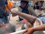 Satu dari lima warga sipil yang menjadi korban penembakan yang dilakukan KKB pimpinan Aibon Kogoya di Nabire, Jumat (17/10). FOTO : ANTARA/HO-Satgas Damai Cartenz