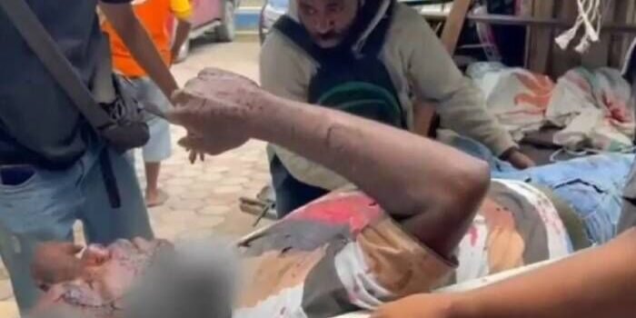 Satu dari lima warga sipil yang menjadi korban penembakan yang dilakukan KKB pimpinan Aibon Kogoya di Nabire, Jumat (17/10). FOTO : ANTARA/HO-Satgas Damai Cartenz