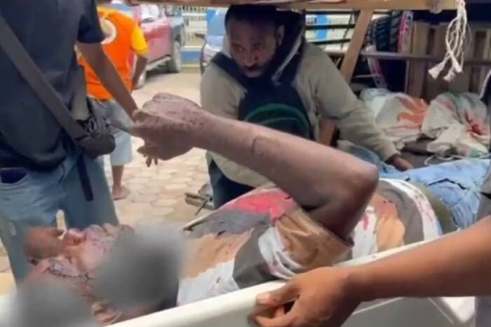 Satu dari lima warga sipil yang menjadi korban penembakan yang dilakukan KKB pimpinan Aibon Kogoya di Nabire, Jumat (17/10). FOTO : ANTARA/HO-Satgas Damai Cartenz